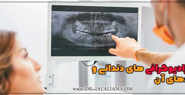 انواع رادیوگرافی های دندانی