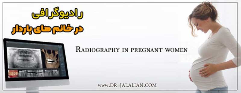 تهیه رادیوگرافی در خانم های باردار