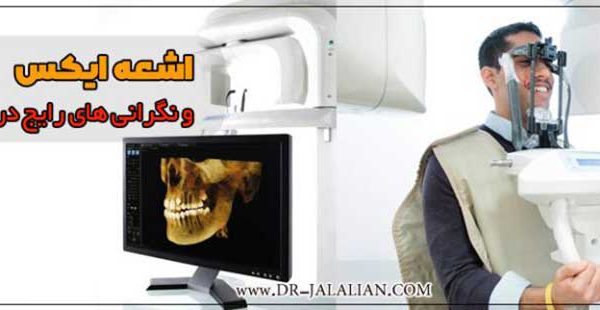 اشعه ایکس در دندانپزشکی و نگرانی های رایج درباره آن