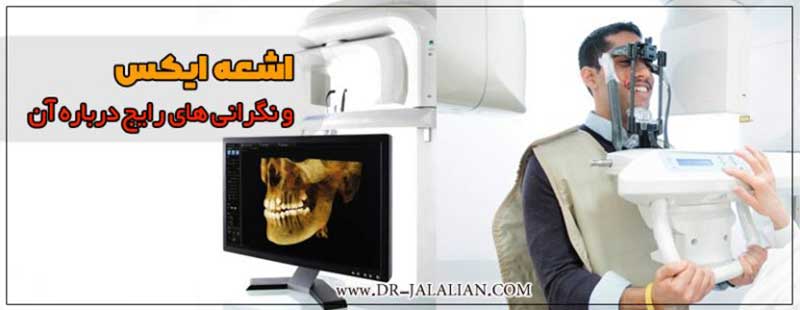 اشعه ایکس در دندانپزشکی و نگرانی های رایج درباره آن